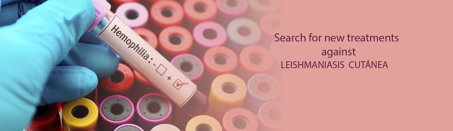 Search for new treatments against Leishmaniasis Cutanea