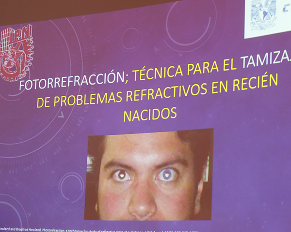 Detecta IPN defectos visuales en bebés con técnica innovadora