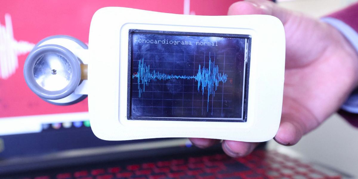Crean en IPN estetoscopio que detecta daño cardiaco  mediante Inteligencia Artificial