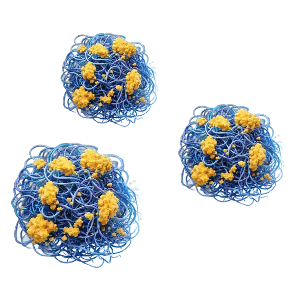 Nuevo hallazgo redefine cómo inicia el Alzheimer