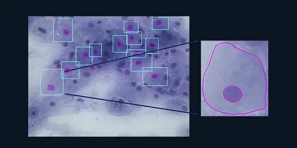 Aceleran en el CIC detección de cáncer cervicouterino con IA
